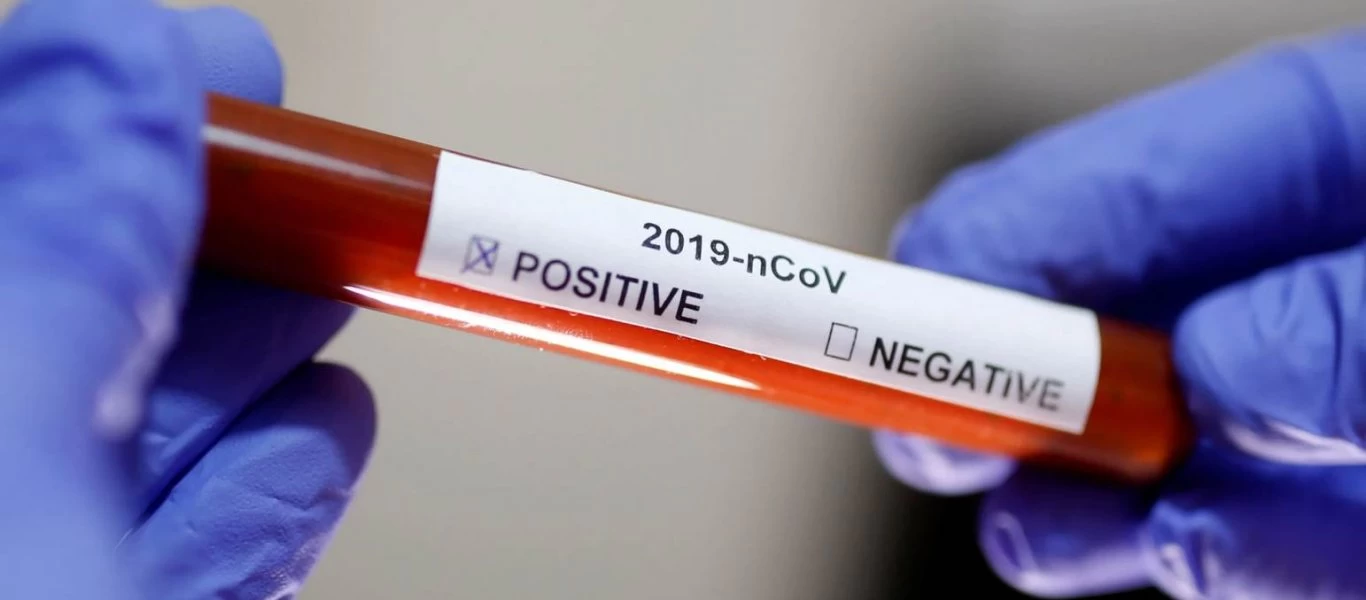 Δύο διαφορετικά αποτελέσματα είχαν τα τεστ κορωνοϊού που έκανε ο αρχηγός της Εθνοφρουράς των ΗΠΑ